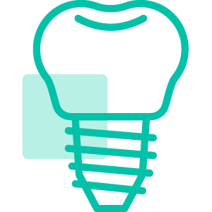Implantacija